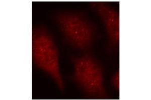 Immunofluorescence staining of methanol-fixed Hela cells using Phospho-CDK6-Y24 antibody. (CDK6 antibody  (pTyr24))
