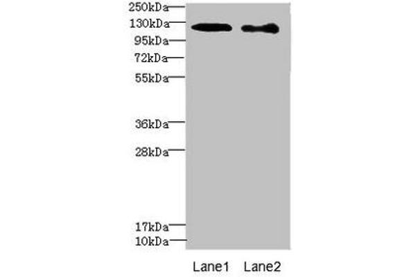 DIAPH2 antibody  (AA 1-120)