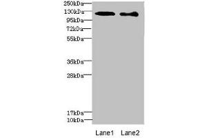 DIAPH2 antibody  (AA 1-120)