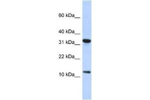 Western Blotting (WB) image for anti-Basic Transcription Factor 3 Pseudogene 11 (BTF3P11) antibody (ABIN2458156)