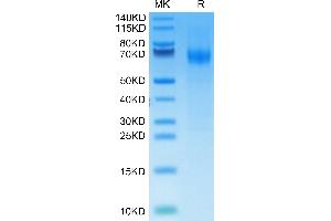 Mouse IFNAR1 on Tris-Bis PAGE under reduced condition. (IFNA Protein (AA 27-429) (His-Avi Tag))