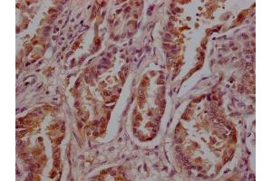 Immunohistochemistry (IHC) image for anti-14-3-3 zeta (YWHAZ) (AA 133-212) antibody (ABIN7142109)