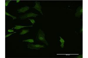 Immunofluorescence of monoclonal antibody to HHEX on HeLa cell. (HHEX antibody  (AA 133-237))