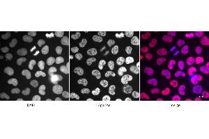 Detection of H3panAc by immunofluorescence. (Histone 3 antibody  (acLys))