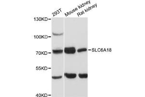 Western blot analysis of extracts of various cell lines, using SLC6A18 antibody (ABIN6290962) at 1:3000 dilution. (SLC6A18 antibody)