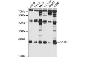 Western blot analysis of extracts of various cell lines, using GOSR2 antibody (ABIN1680068, ABIN3018813, ABIN3018814 and ABIN6220587) at 1:1000 dilution. (GOSR2 antibody  (AA 1-190))