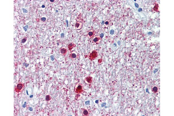 ONECUT1 antibody  (C-Term)