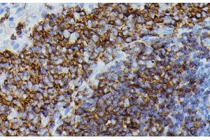 Immunohistochemistry of paraffin-embedded Rat spleen using APOC3 Polyclonal Antibody at dilution of 1:100 (40x lens). (APOC3 antibody)