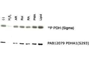 Western blot analysis of PDHA1 in an in vitro autophosphorylation of PDH complex in response to different stimulants with PDHA1 (phospho S293) polyclonal antibody .