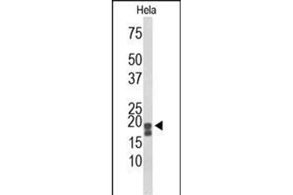 ACP1 antibody  (N-Term)