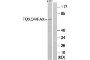 Western blot analysis of extracts from K562 cells, treated with serum, using AFX (Ab-197) Antibody. (FOXO4 antibody  (AA 164-213))