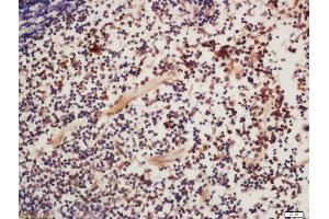 Formalin-fixed and paraffin embedded mouse spleen labeled with Rabbit Anti-FAK (Tyr925) Polyclonal Antibody, Unconjugated  at 1:200 followed by conjugation to the secondary antibody and DAB staining (FAK antibody  (pTyr925))