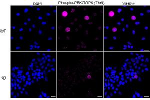 Immunocytochemical staining of HeLa cells using Phospho-PBK/TOPK (Thr9) antibody (ABIN7799752), 1:1,000), Top panel: wild-type (WT), Bottom panal: Phospho-PBK/TOPK (Thr9) shRNA knockdown (KD).
