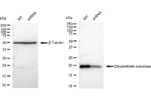 Western blotting analysis using Dihydrofolate reductase antibody (ABIN7798334).