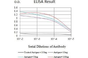 Black line: Control Antigen (100 ng),Purple line: Antigen (10 ng), Blue line: Antigen (50 ng), Red line:Antigen (100 ng) (CKM antibody  (AA 1-381))