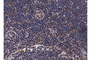 ABIN6266697 at 1/100 staining human lymph node tissue sections by IHC-P.