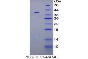SDS-PAGE (SDS) image for Carboxypeptidase B1 (Tissue) (CPB1) (AA 120-415) protein (His tag) (ABIN2124232)