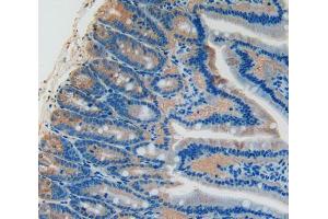 Used in DAB staining on fromalin fixed paraffin- embedded intestine tissue (PLAT antibody  (AA 311-487))