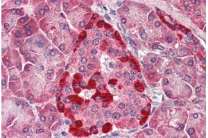 Human Pancreas (formalin-fixed, paraffin-embedded) stained with CASP1 antibody ABIN461892 at 5 ug/ml followed by biotinylated goat anti-rabbit IgG secondary antibody ABIN481713, alkaline phosphatase-streptavidin and chromogen. (Caspase 1 antibody)