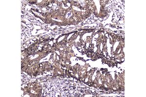 IHC analysis of Caspase 4 using anti-Caspase 4 antibody . (Caspase 4 antibody  (AA 111-194))