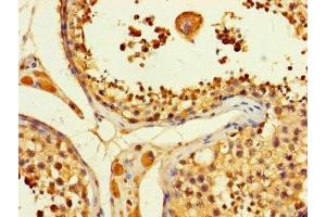 Immunohistochemistry of paraffin-embedded human testis tissue using ABIN7144946 at dilution of 1:100 (ACLY antibody  (AA 4-265))