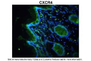 Immunohistochemistry (IHC) image for anti-Chemokine (C-X-C Motif) Receptor 4 (CXCR4) (N-Term) antibody (ABIN2779387)