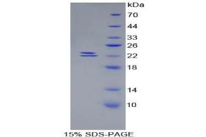 SDS-PAGE analysis of Mouse BMP1 Protein.