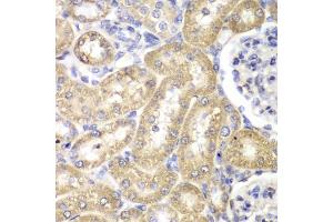 Immunohistochemistry of paraffin-embedded rat liver using HADH antibody (ABIN5970434) at dilution of 1/100 (40x lens).
