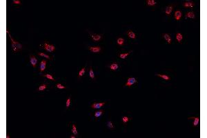 ABIN6266588 staining U-2 OS cells by IF/ICC. (MDM2 antibody)