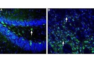 Expression of Homer1 in mouse hippocampus and striatum - Immunohistochemical staining of perfusion-fixed frozen mouse brain sections using Anti-Homer1 Antibody (ABIN7043273, ABIN7045168 and ABIN7045169), (1:400), followed by goat-anti-rabbit-AlexaFluor-488 secondary antibody. (HOMER1 antibody  (Intracellular))