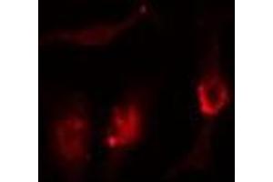 ABIN6276347 staining  293 cells by IF/ICC. (SIRT2 antibody  (C-Term))