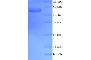 PDIA2 Protein (AA 21-527) (His tag)