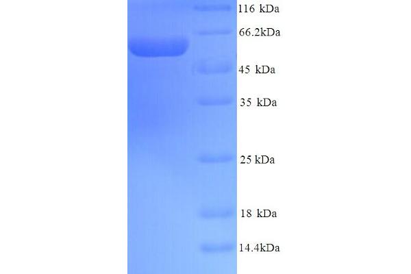 PDIA2 Protein (AA 21-527) (His tag)