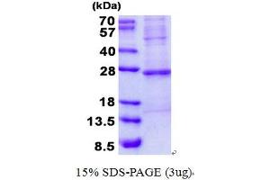 Image no. 1 for Fast Skeletal Troponin I (TNNI2) protein (His tag) (ABIN1098700)
