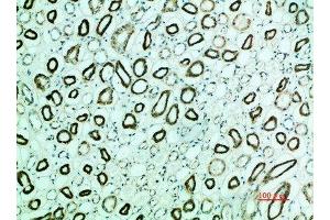 Immunohistochemical analysis of paraffin-embedded human-kidney, antibody was diluted at 1:200 (PTH1R antibody  (AA 1268-1341))