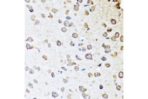 Immunohistochemistry of paraffin-embedded mouse brain using SERPINA10 antibody (ABIN5974273) at dilution of 1/100 (40x lens).