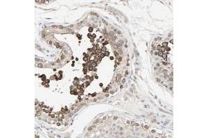 Immunohistochemical staining of human testis with JMJD2A polyclonal antibody  shows strong cytoplasmic positivity in cells in seminiferus ducts. (KDM4A antibody)