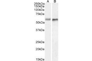 Western Blot using anti-BACE2 antibody 1/9 HeLa (A) and U251 (B) cell lysate samples (35 μg protein in RIPA buffer) were resolved on a 10 % SDS PAGE gel and blots probed with the chimeric mouse IgG1 version of 1/9 (ABIN7072331) at 1 μg/mL before detection using an anti-mouse secondary antibody. (Recombinant BACE2 antibody)