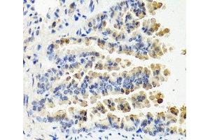 Immunohistochemistry of paraffin-embedded Mouse lung using NTF3 Polyclonal Antibody at dilution of 1:100 (40x lens). (Neurotrophin 3 antibody)