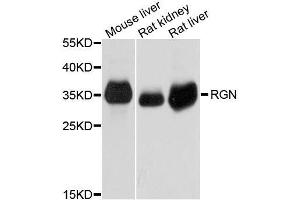 Western blot analysis of extracts of various cell lines, using RGN antibody. (Regucalcin antibody  (AA 1-299))