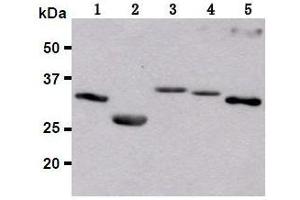 Western Blotting (WB) image for anti-Red Fluorescent Protein (RFP) antibody (ABIN1449291) (RFP antibody)