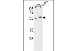 Western blot analysis of hGALK2-M1 (ABIN391115 and ABIN2841245) in HL-60, NCI- cell line lysates (35 μg/lane). (GALK2 antibody  (N-Term))