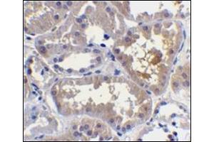 Immunohistochemistry of RAIDD in human kidney tissue with this product at 10 μg/ml. (CRADD antibody  (C-Term))