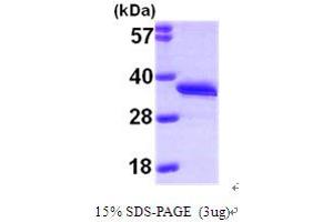 SDS-PAGE (SDS) image for Deoxycytidine Kinase (DCK) (AA 1-260) protein (His tag) (ABIN667827)