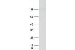 Validation with Western Blot (ZNF217 Protein (Myc-DYKDDDDK Tag))