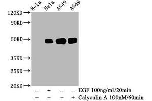 Western Blot  Positive WB detected in: Hela whole cell lysate, A549 whole cell lysate(treated with Calyculin A or EGF)  All lanes: Phospho-JUN antibody at 0. (Recombinant C-JUN antibody  (pSer63))