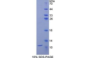 SDS-PAGE analysis of Rat CD3d Protein. (CD3D Protein)