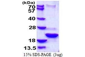 SDS-PAGE (SDS) image for Thioredoxin-Like 4B (TXNL4B) (AA 1-149) protein (His tag) (ABIN667921) (TXNL4B Protein (AA 1-149) (His tag))