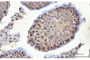 IHC analysis of MSY2/YBOX2/YBX2 using anti-MSY2/YBOX2/YBX2 antibody (ABIN7600636). (YBX2 antibody  (AA 211-364))