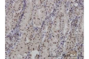 Immunohistochemistry (Formalin-fixed Paraffin-embedded Sections) (IHC (fp)) image for anti-Forkhead Box O3 (FOXO3) (AA 361-460) antibody (ABIN515739)